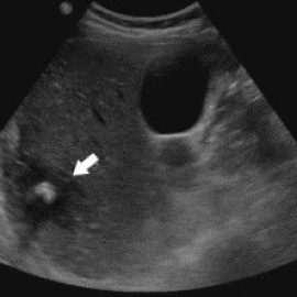 Ultrasonography