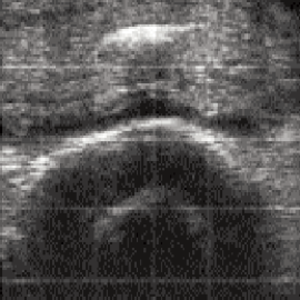 embryonics Ultrasound