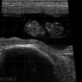 scanning